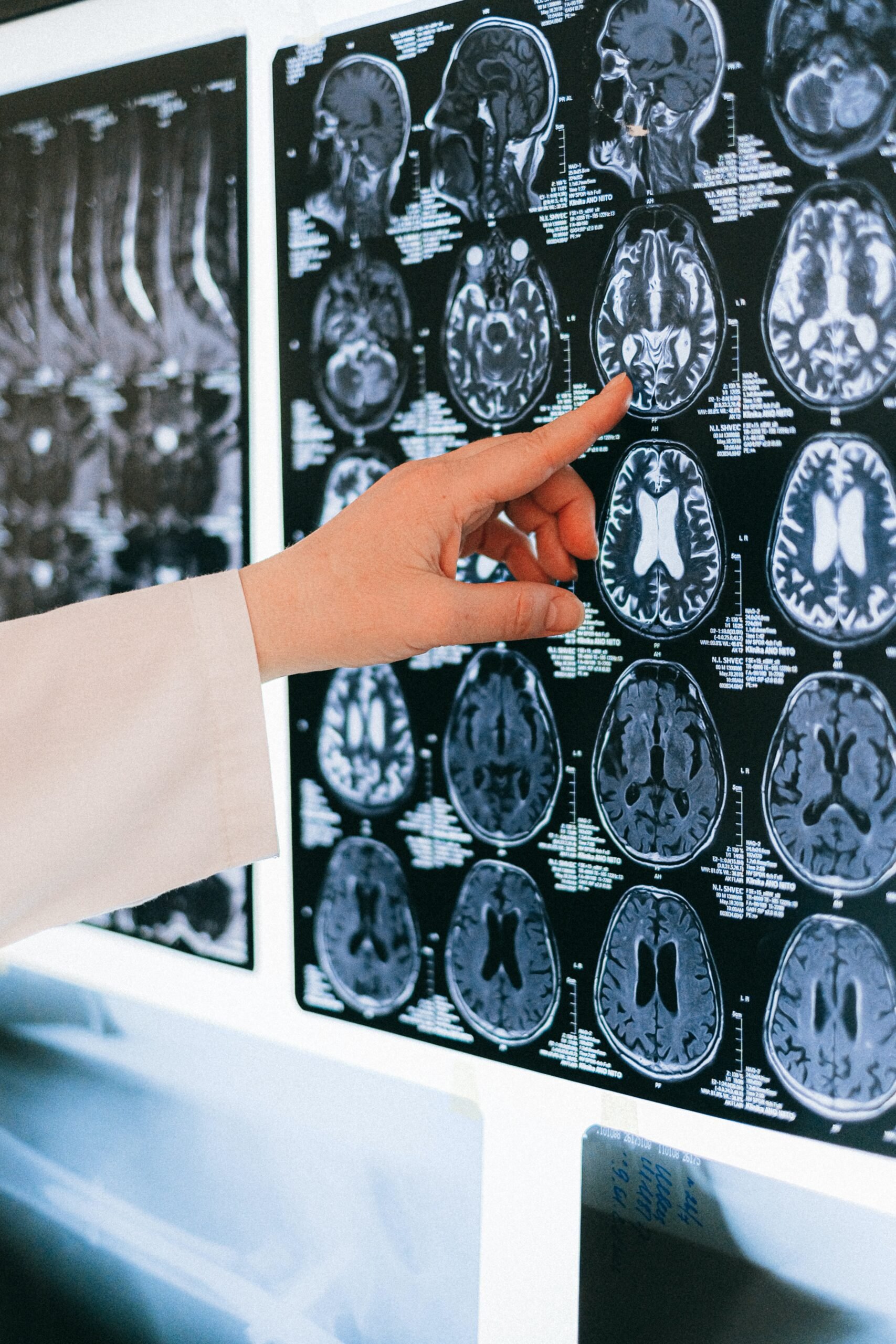 Memory-Loss-Science-Picture