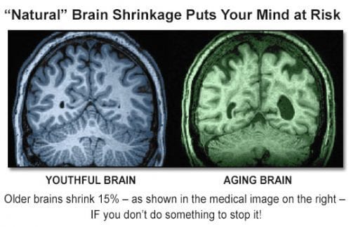 brain-young-old-e1509557051965 Young vs old brain