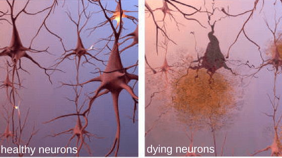 healthy-neurons